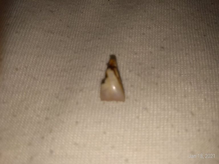 tooth1.jpg