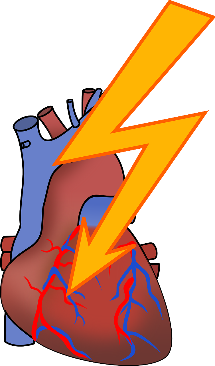 arrhythmia-156099_1280.png