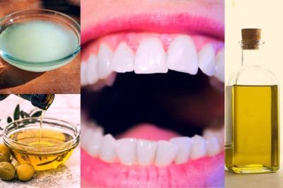 Oil-pulling-for-teeth-e1584283062625.jpg