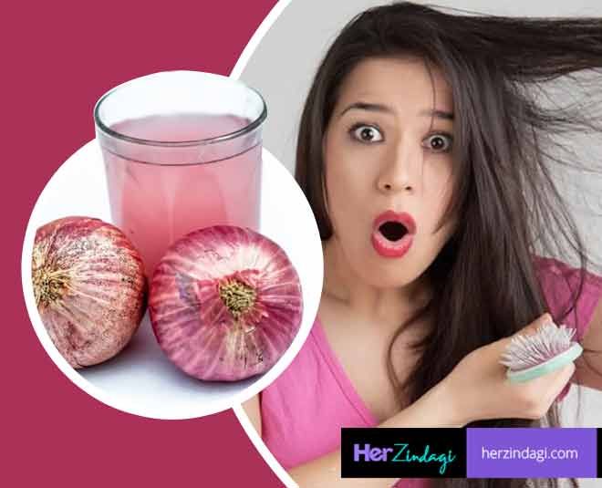 best-onion-hair-packs-to-improve-scalp-health.jpg