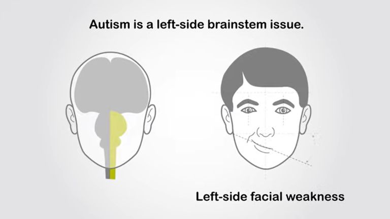 Autism-2.jpg