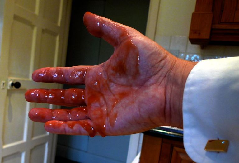 blood in hands.JPG