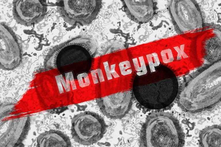 monkey-pox-7217582_1280.webp