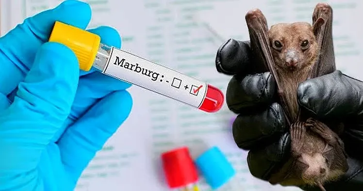 Marburg-Virus-Outbreak.webp